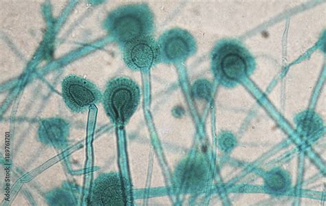 Aspergillus under microscope Stock Photo | Adobe Stock