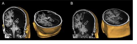 Figure 1 from The superior colliculus is sensitive to gestalt-like ...