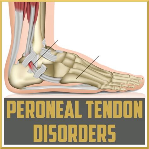 Peroneus Tertius Tendon