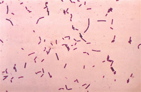 Bacillus Species Gram Stain - vrogue.co