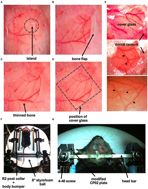 Surgical procedure for craniotomy with dura removal. (A) Image of part... | Download Scientific ...