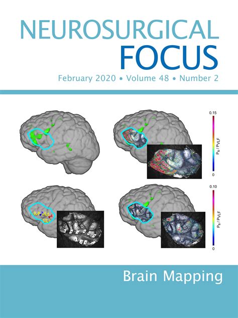 hasemdates.blogg.se - Analysis of functional mri time-series. human ...