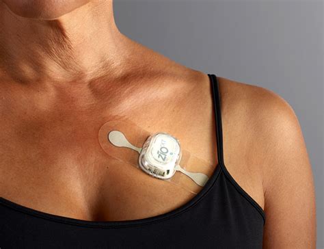 The Zio patch cardiac monitor continuously records heart rhythm data for up to 14 days. Unlike ...