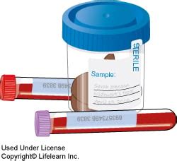 Colitis in Dogs | VCA Animal Hospital