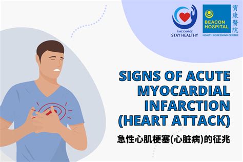 Signs of Acute Myocardial Infarction (Heart Attack) – Beacon Health ...