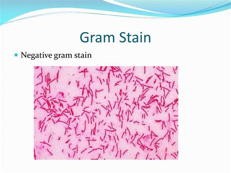 PPT - Borrelia burgdorferi PowerPoint Presentation, free download - ID:6949233