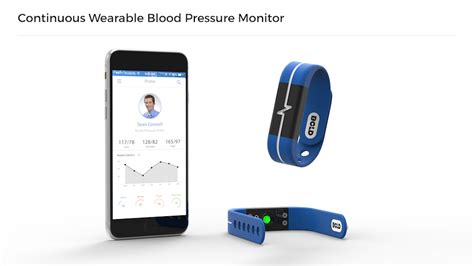 Continuous Wearable Blood Pressure Monitor :: Create the Future Design Contest