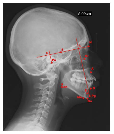 Digital | Free Full-Text | Design of Open Code Software to Downs and Steiner Lateral ...