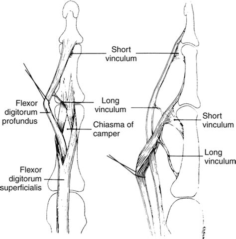 Fdp And Fds Tendons Anatomy - Soft Tissue Injuries Of The Hand ...