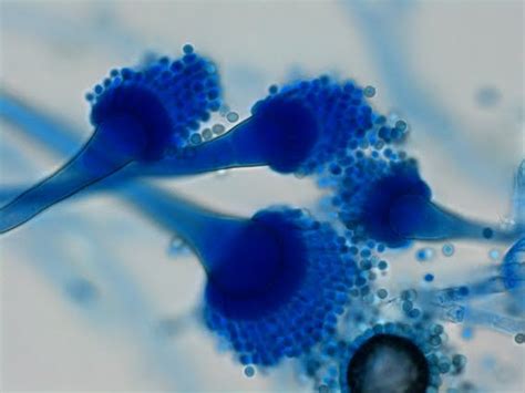 Fun With Microbiology (What's Buggin' You?): Aspergillus fumigatus