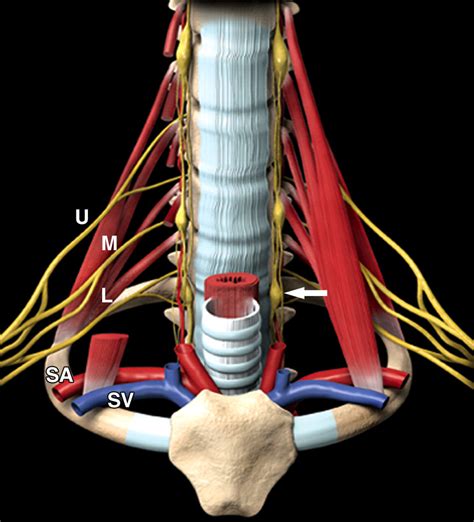 Imaging of Non–Small Cell Lung Cancer of the Superior Sulcus | RadioGraphics