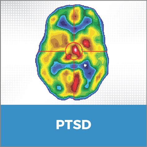 Post-Traumatic Stress Disorder (PTSD) - CereScan