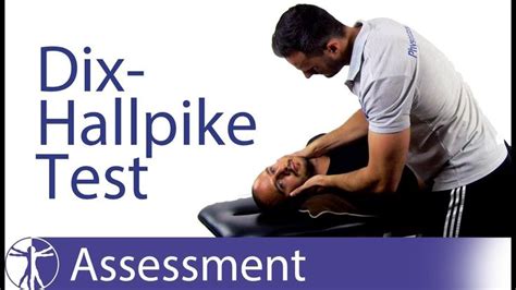 Dix Hallpike Test | Posterior BPPV