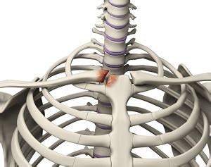 Sternoclavicular Arthritis Kansas City | Shoulder Pain | SC Joint Arthritis Lee’s Summit