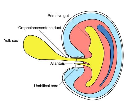 Omphalomesenteric Duct Remnants