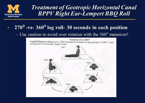 6 Pics Barbecue Roll Horizontal Bppv And Description - Alqu Blog