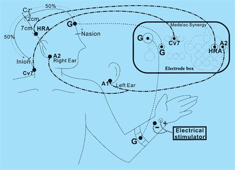 Position of electrodes of left median nerve-somatosensory evoked ...