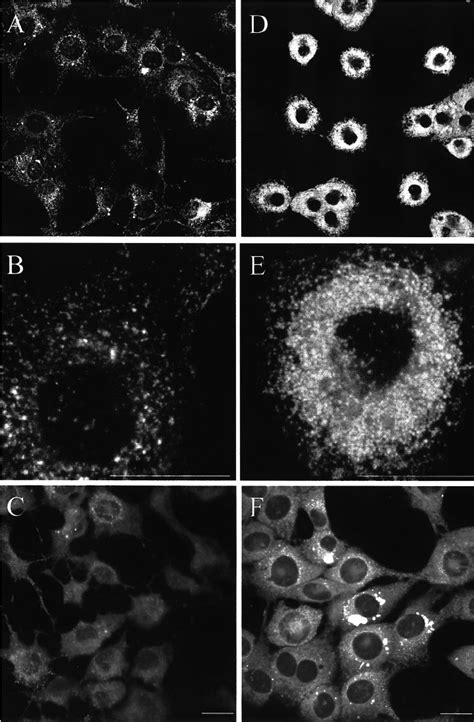 LysoTracker Red labeled C127 control cells ( a ± c ) and E5 transfected ...