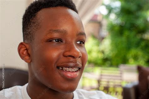 Smiling teenage boy with dental braces Stock Photo | Adobe Stock