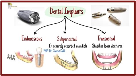 3 Types of Dental Implants and Surface treatments explained! - Dental ...