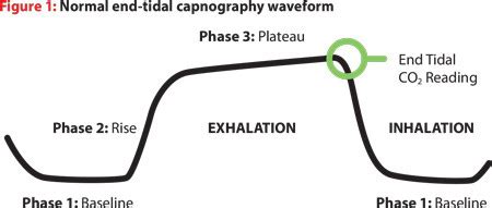 5 reasons to use capnography during cardiac arrest?