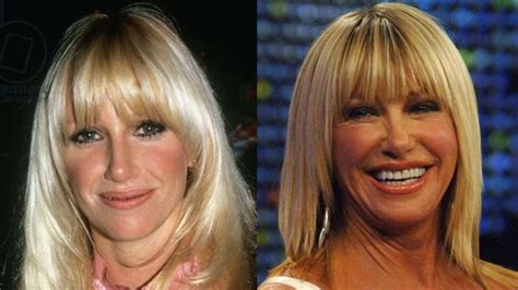 Know About Suzanne Somers’ Plastic Surgery With Her Then and Now Photos!