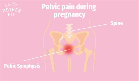 Blog - Symphysis Pubis Dysfunction: Exercises & Strategies To Prevent ...