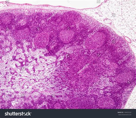 Histological Section Lymph Node Showing Cortex: foto stock (modifica ...