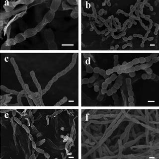 Spore chain morphology of ( a ) Streptomyces griseus Lac1, ( b ...