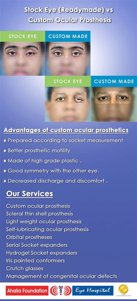 Prosthetic Eye - Ahalia Foundation Eye Hospital