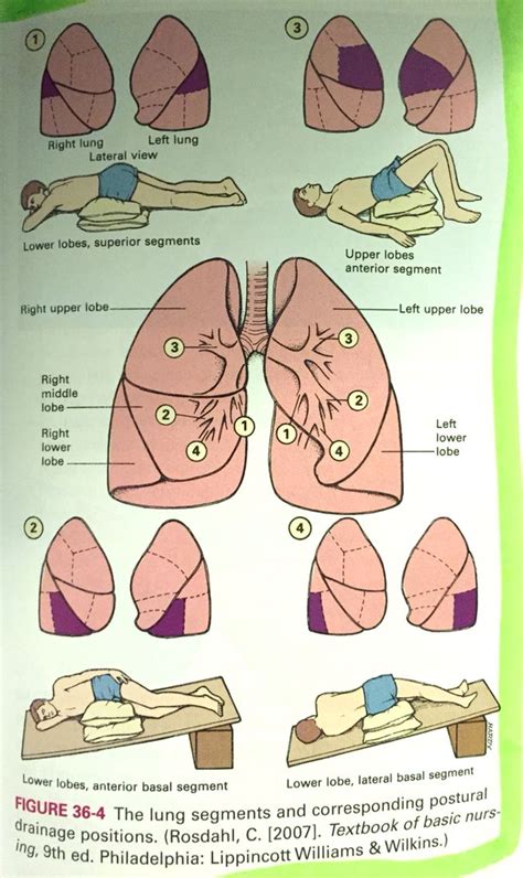 Postural drainage positions | Lvn school, Respiratory therapy, Rn school