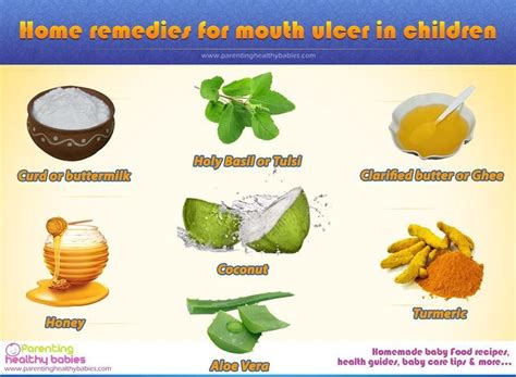 7 Home Remedy for Mouth Ulcer in Children during Summers | Mouth ulcers, Ulcer remedies mouth ...