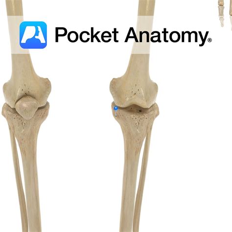 Tibia - medial condyle - Pocket Anatomy