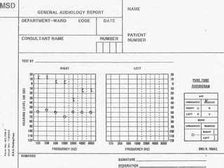 Audiogram & Tympanogram | PPT