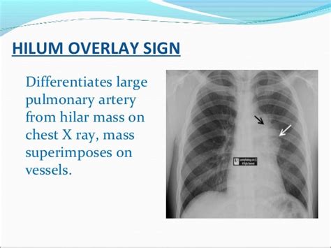 Radiology signs