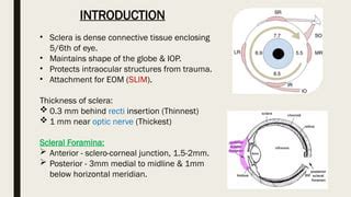 Episcleritis & Scleritis (causes, clinical features, treatment).pptx