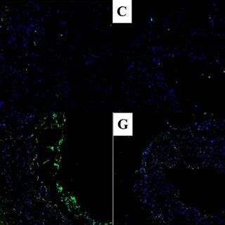 Tunel fluorescence staining (× 100) of cell viability of vessels at... | Download Scientific Diagram