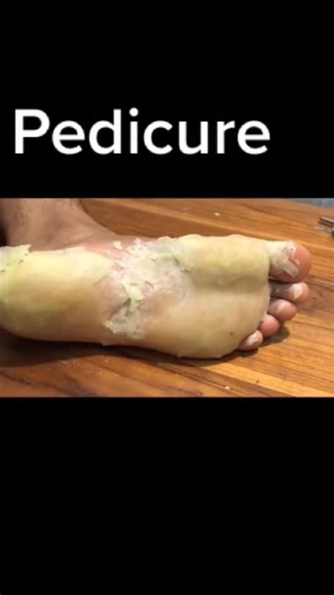 Pedicure | Feet care, Foot remedies, Zit popping videos