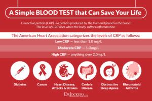 How High C-Reactive protein can risk your chance of Heart Disease! | Strive For Good Health