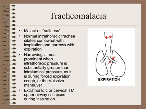 Tracheomalacia