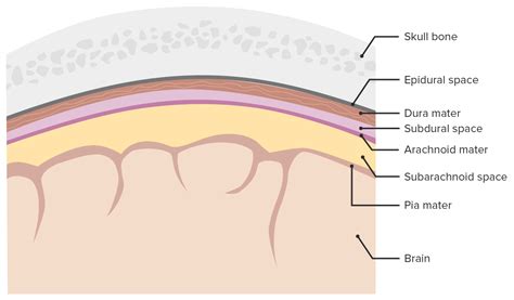 Hemorragia Epidural | Concise Medical Knowledge