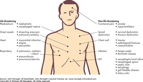 Thread by @DocAWard: "1/10 What is chest pain? - "Pain anywhere in the chest" - Many things ...