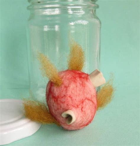 Teratoma Tumor Specimen Jar