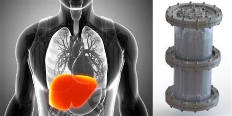 Helping to develop a Bio-Artificial Liver - Europlaz