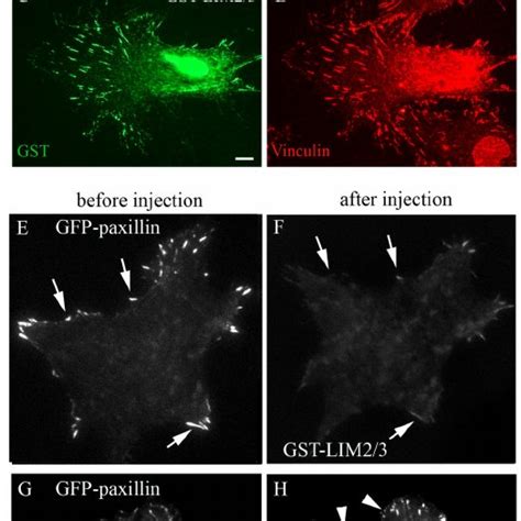 (PDF) Paxillin-dependent stimulation of microtubule catastrophes at focal adhesion sites