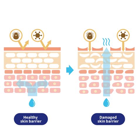 Picky Guide: All About Skin Barrier – COSRX Official