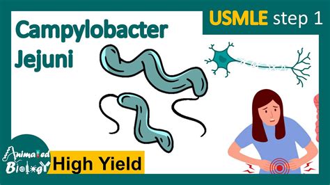 Campylobacter jejuni | Pathology | Campylobacter jejuni and Guillain ...