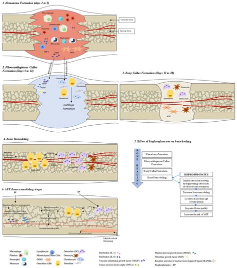 JCM | Free Full-Text | Advancement in the Treatment of Osteoporosis and the Effects on Bone Healing