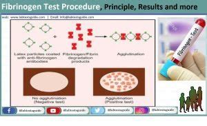 Fibrinogen Test Procedure, Principle, Results and more | Lab Tests Guide