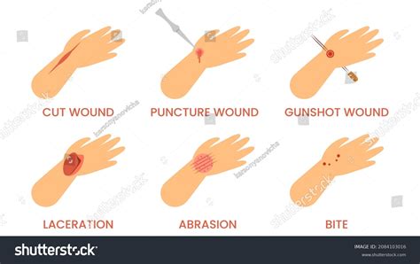 2,159 Laceration Injury Images, Stock Photos & Vectors | Shutterstock